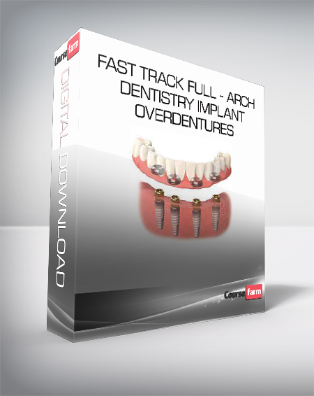 Fast Track Full - Arch Dentistry Implant Overdentures